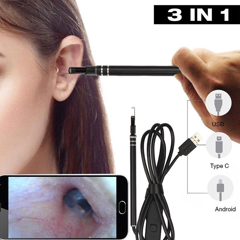 Best of Ear Otoscope Megapixels Ear Scope Inspection Camera USB Ear Digital Endoscope Earwax Cleansing Tool With 6led Reviews & Tips