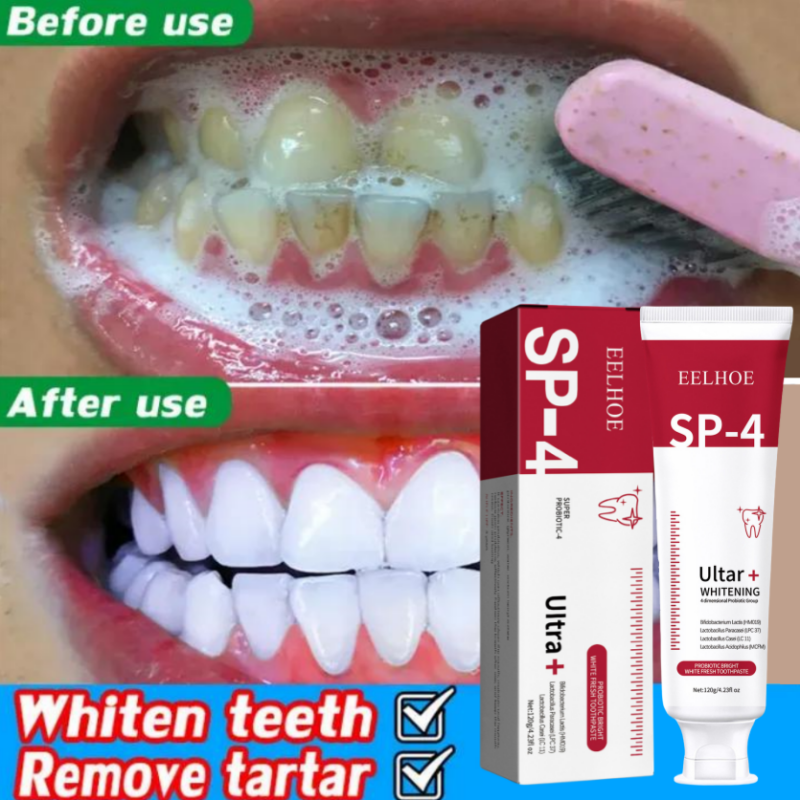 Best of SP-4 Probiotic Caries Toothpaste Whitening Tooth Decay Repair Paste Removal Yellow Plaque Stain Bad Breath Fresh Oral Clean Care Reviews & Tips