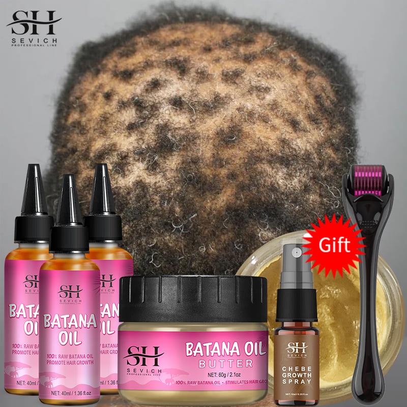 Best of African Batana Oil Baldness Hereditary Postpartum Seborrheic Hair Regrowth Treatment Serum Batana Oil Hair Growth For Men Women Reviews & Tips