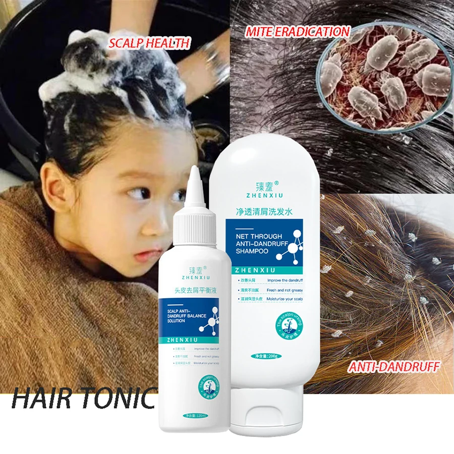 Best of Hair Care Set Anti-Dandruff Shampoo Lice Mites Remover Shampoo Scalp Follicle Dissolve Oil Antipruritic Anti Hair Loss Treatment Reviews & Tips