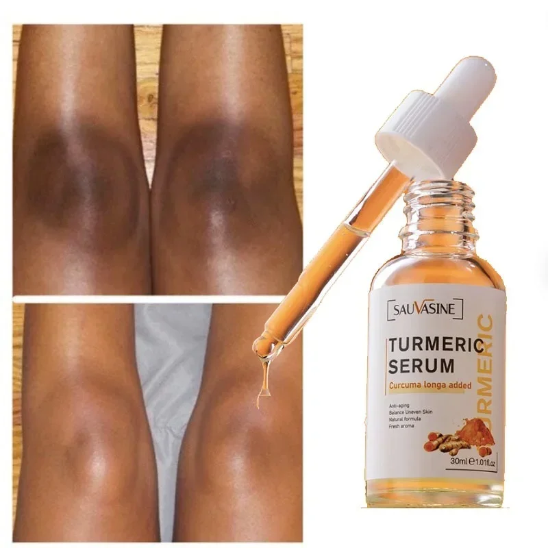 Best of Turmeric Serum Skin Glow To Lightening Acne Dark Patches, Acne Bright Dark Spot Corrector Face Whitening Serum Skin Care Reviews & Tips