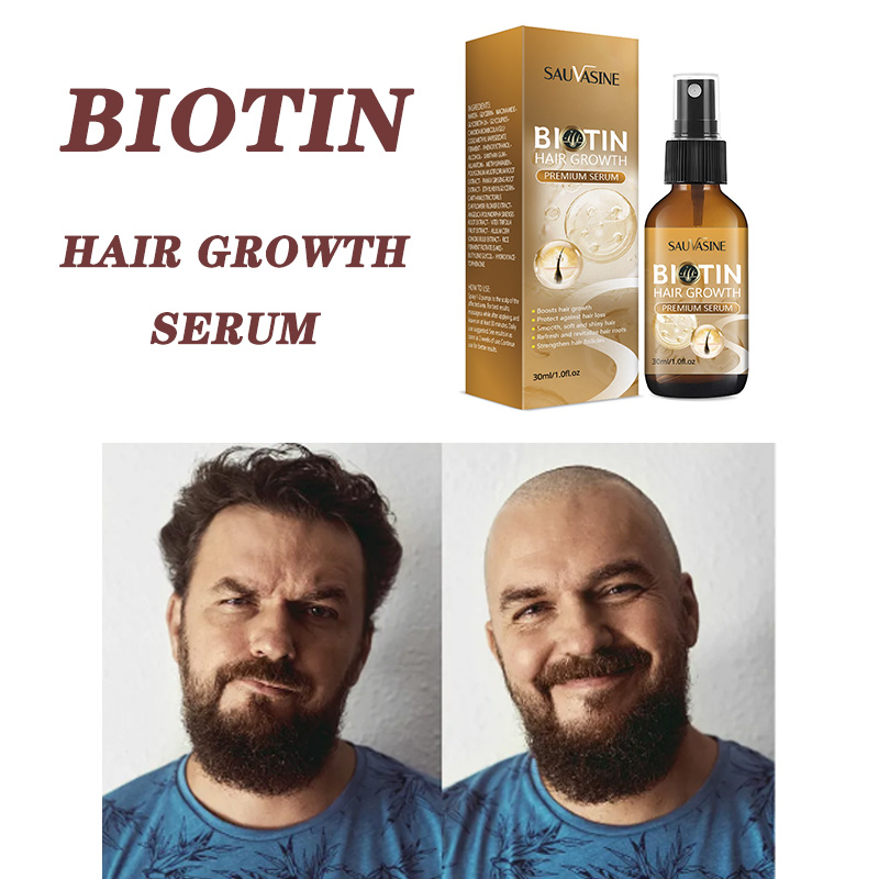 Best of Fast Hair Growth Products Biotin Spray Treatment Of Hereditary Alopecia Postpartum Alopecia Pattern Biotin For Hair Growth Reviews & Tips