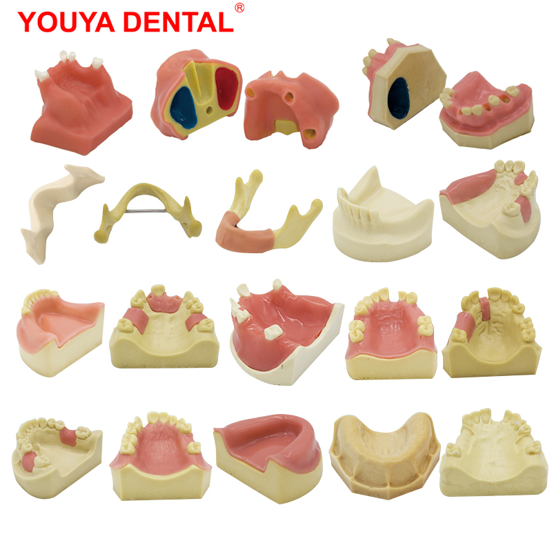 Best of YOUYA 1PCS Dental Model Teeth Implant Practice Model Tooth Dental Implant Model Training Display Dentistry Oral Teaching Models Reviews & Tips