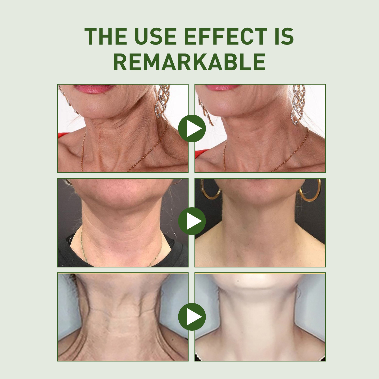 Neck Cream Firming Anti Wrinkle Tightening Remove Dark Spot Rejuvenation Skin Whitening Moisturizing Lines Gone Neck Gel Female_voghion.com