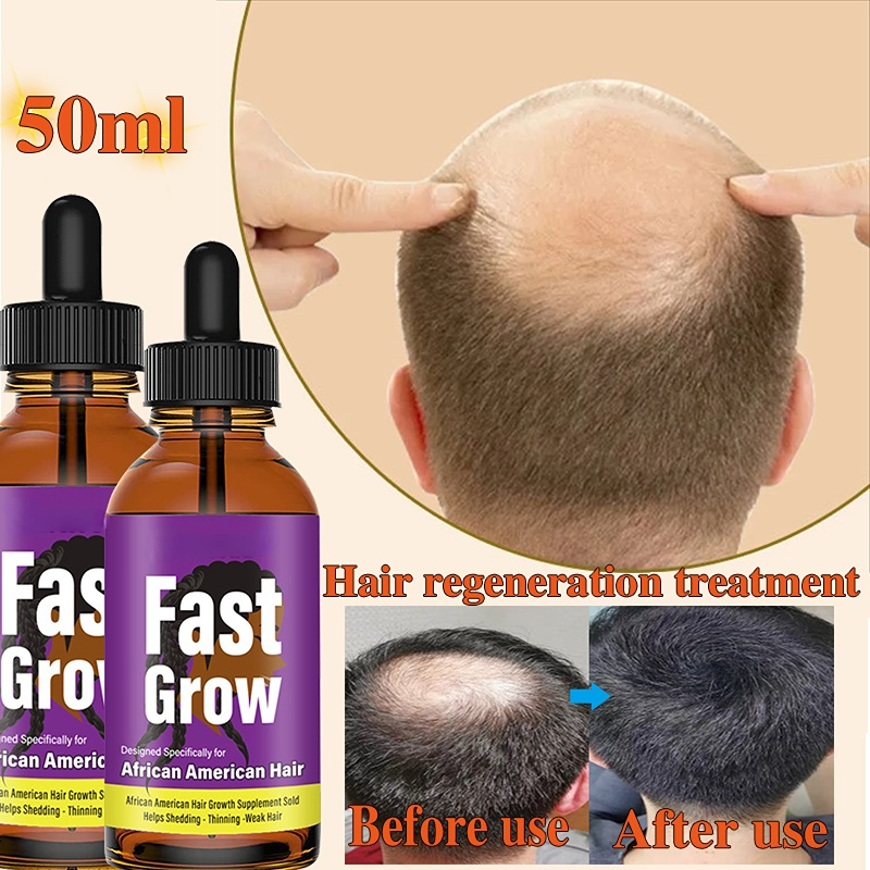 Best of Hair Growth Oil For Black Women Anti Alopecia Essential Oils Hair Treatment Scalp Thinning Hair Growth Solution Anti Hair Loss Reviews & Tips