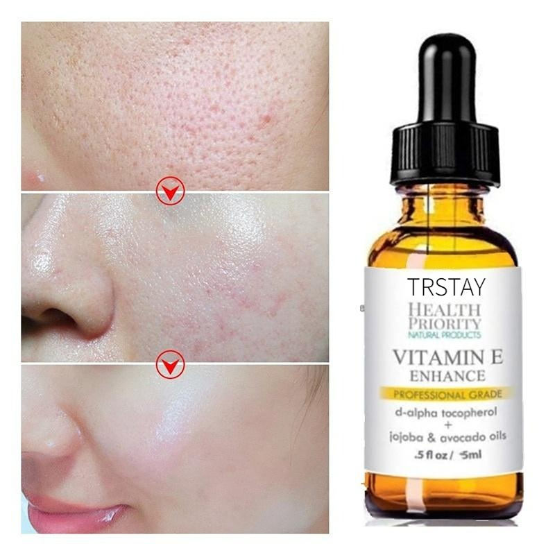 Best of Face Essence Essential OilsVitamin E Skin Oil 100% Nature Face Serum Anti-Wrinkle Moisturizing Tight Whitening Skin Care Essence Reviews & Tips