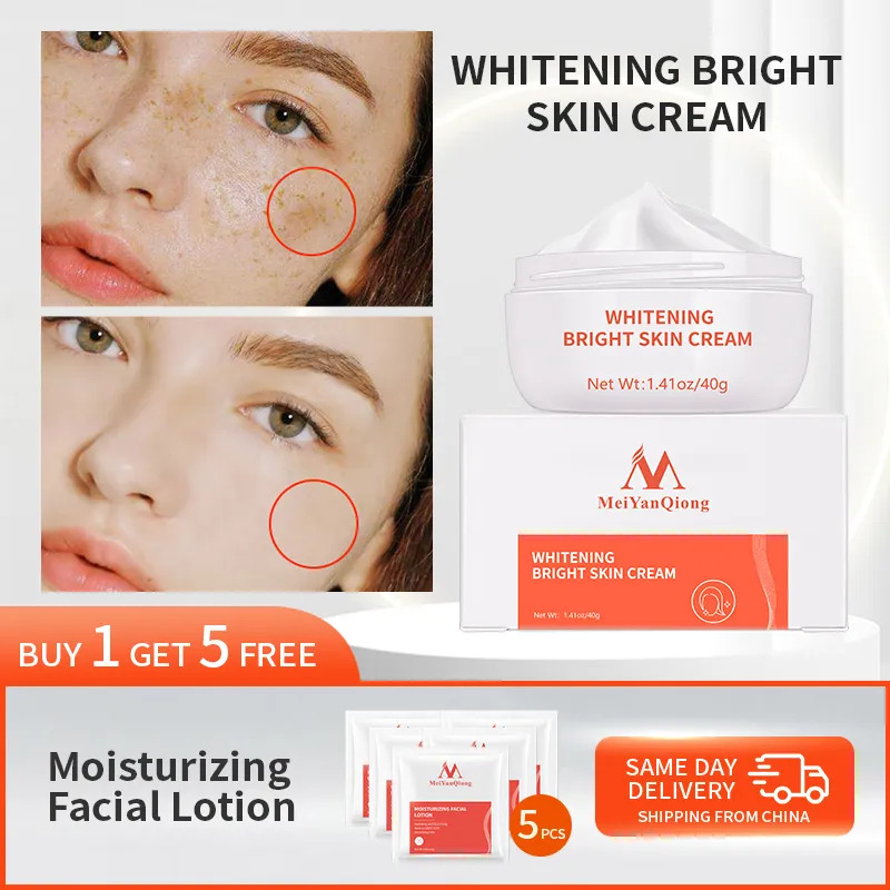 Best of Moisturiser Face Whitening Freckle Cream Remove Acne Spots Melanin Dark Spots Face Lift Firming Face Skin Care Bright Skin Cream Reviews & Tips