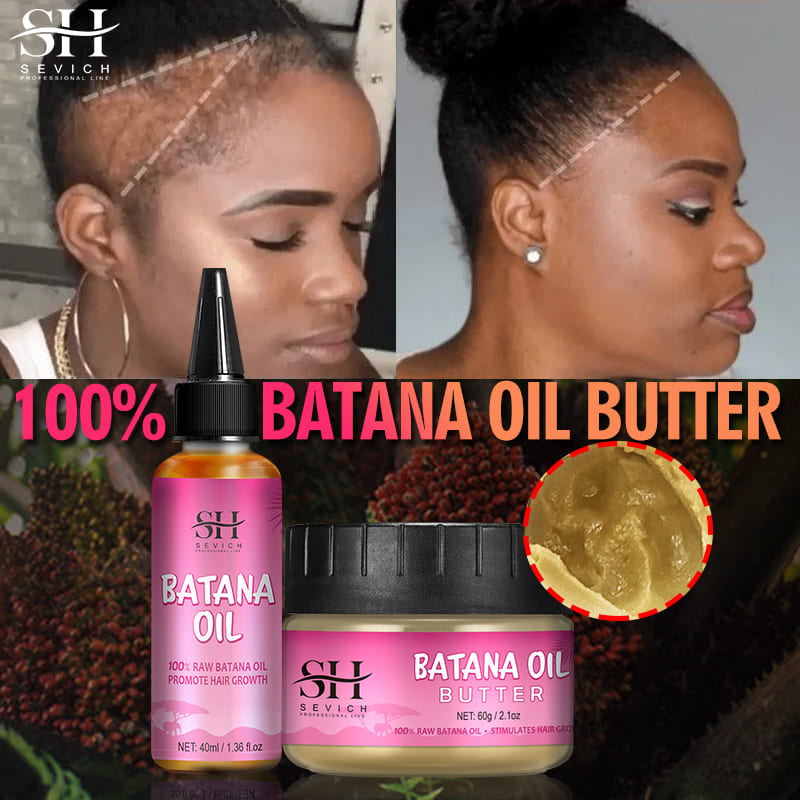 Best of 100% Pure Batana Oil For Hair Growth Scalp Massage Oil Natural Batana Butter For Black Women Anti Hair Loss Treatment Hair Care Reviews & Tips