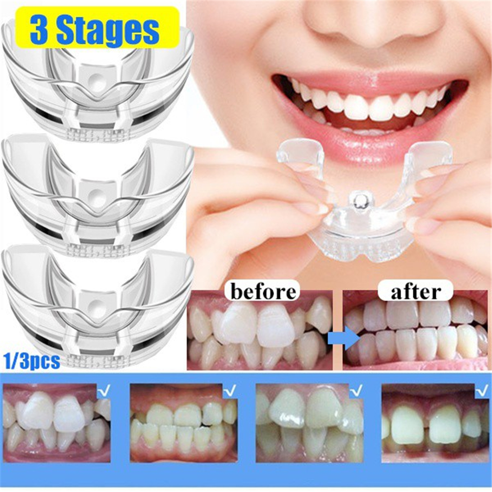 Best of 3 Stages Silicone Tooth Invisible Orthodontic Set Dental Appliance Teeth Retainer Mouth Guard Braces Tooth Tray Tooth Care Tool Reviews & Tips