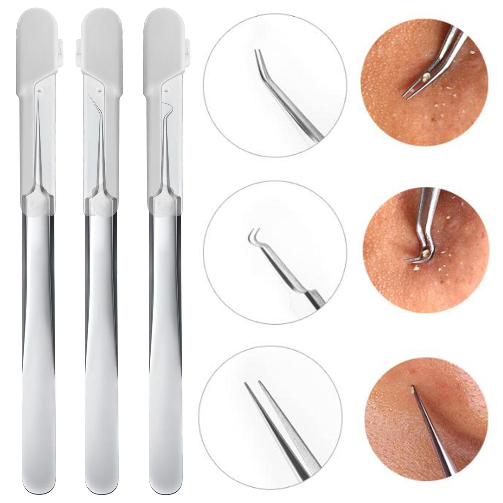 Blackhead Tweezer Remove Blackhead Whitehead Pimple Skin Care Women Blemish Acne Remover Face Beauty Tools Comedone Extractor