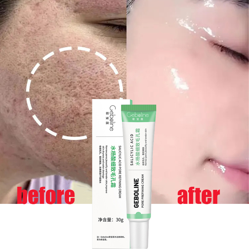 Best of Salicylic Acid Pore Shrinking Cream Quick Elimination Large Pores Remove Blackehead Tighten Face Smooth Skin Korean Care Product Reviews & Tips