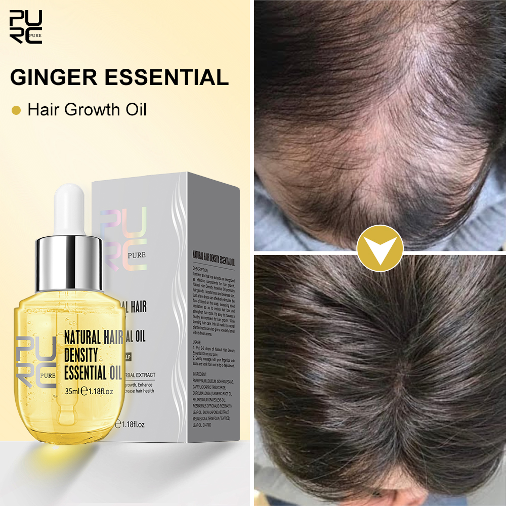 Best of Hair Growth Products Men Women Ginger Fast Regrowth Oil Anti Hair Loss Scalp Treatment Serum Thicken Grow Hair Care Oil PURC Reviews & Tips