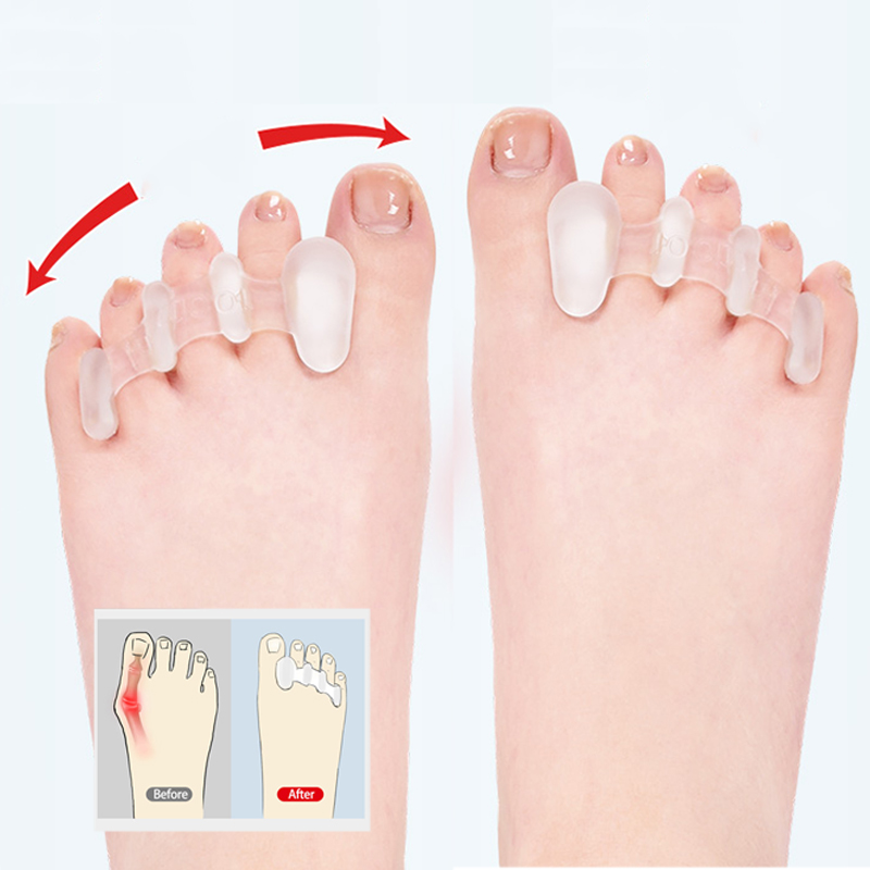 Best of Silicone Toes Separator Bunion Bone Ectropion Adjuster Toes Outer Appliance Foot Care Tools Hallux Valgus Corrector Reviews & Tips