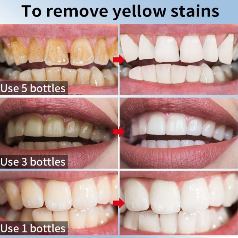 Best of Dental Calculus Remover Whitening Teeth Toothpaste Mouth Odour Removal Bad Breath Prevent Periodontitis Caries Repair Tooth Care Reviews & Tips - Image 2