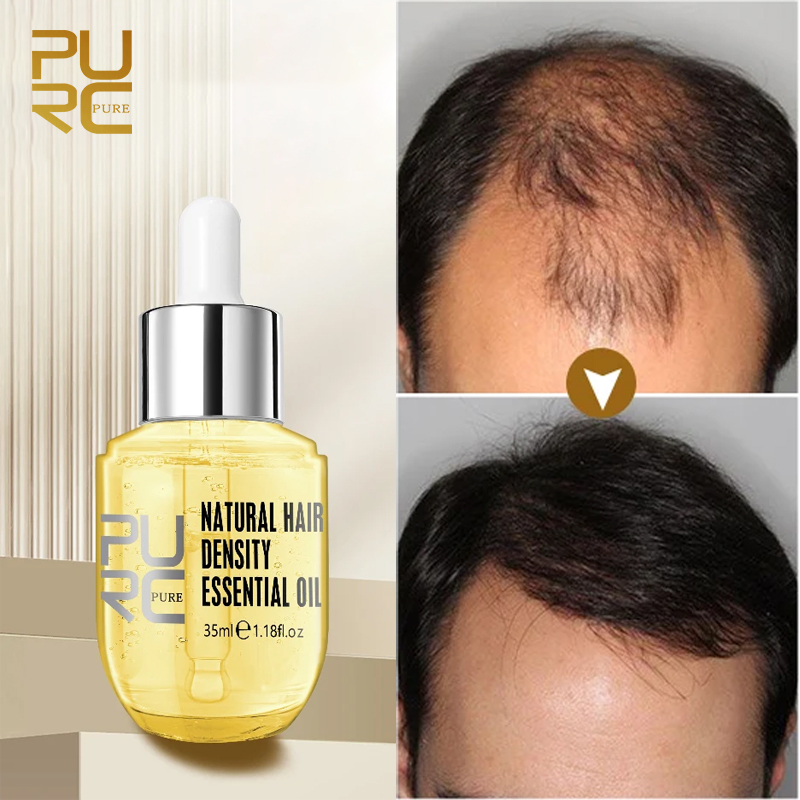 Best of PURC Hair Growth Oil For Men Women Ginger Anti Hair Loss Care Fast Regrowth Thickener Scalp Treatment Hair Growth Products Reviews & Tips