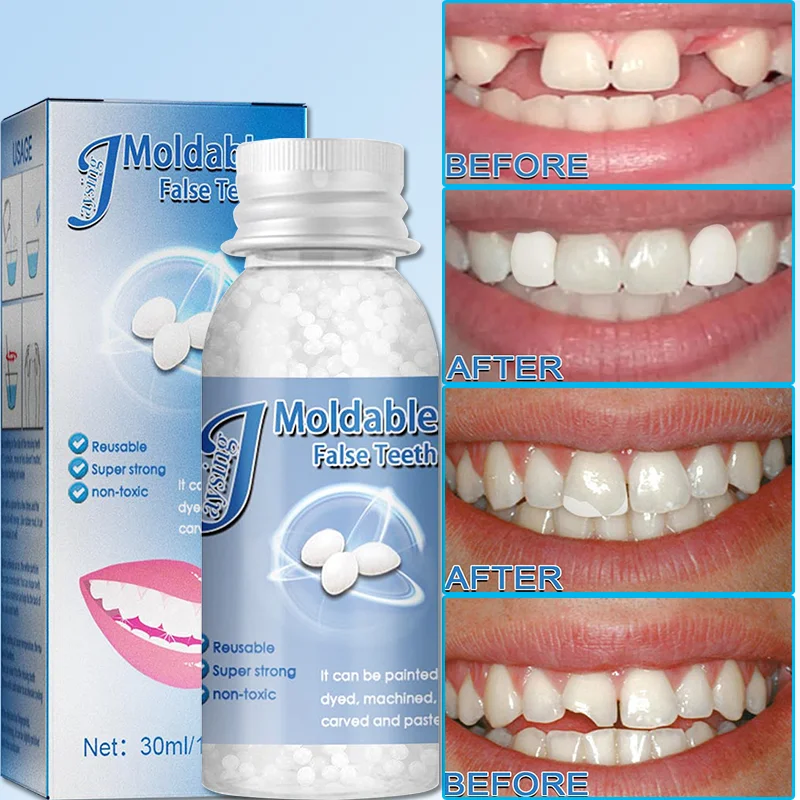 Best of 30ml Plastic Resin Temporary Tooth Repair Granules Denture Adhesive Teeth Gaps Broken Moldable Solid Glue Dental Beauty Tools Reviews & Tips