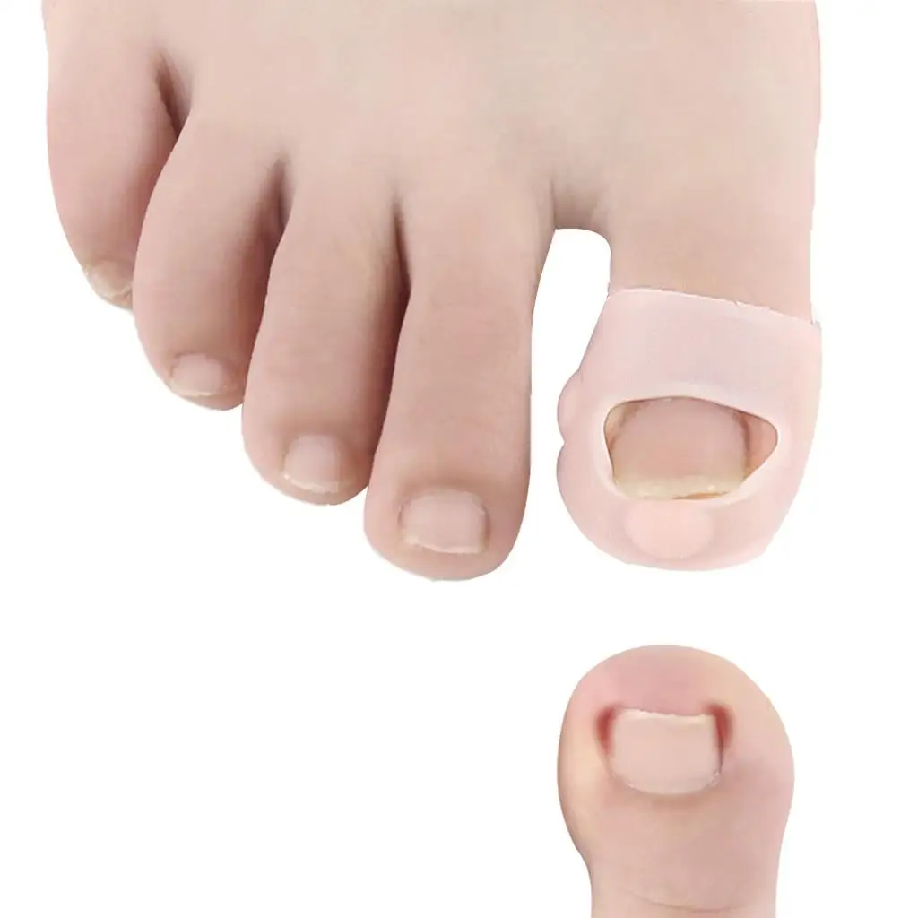 5 Pairs Silicone Ingrown Toenail Corrector Gel, Toe Nails Orthodontics  Protector Sleeves, Durable, Elastic