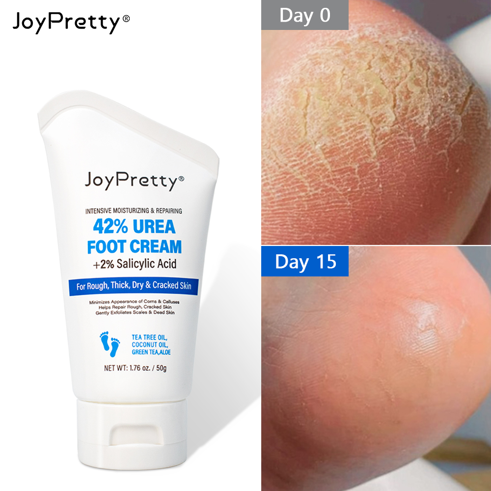 Best of Keratin Foot Cream Feet Dead Skin Removal Nail Crack Heel Moisturizing Treatment Exfoliation Hand Creams Skin Care Beauty Health Reviews & Tips