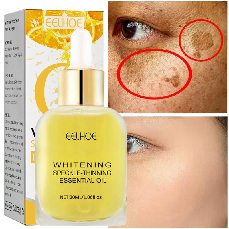 Best of Effective Whitening Freckle Serum Products Vitamin C Remove Dark Spots Face Serum Fade Pigmentation Melasma Brighten Skin Care Reviews & Tips