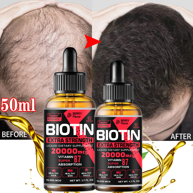 Best of Fast Hair Growth Oil Hair Regeneration Essence Hair Thinning Treatment Hair Growth Fluid Anti-Hair Loss Care For Men And Women Reviews & Tips