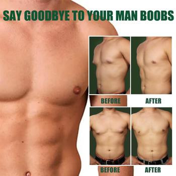 Men Chest Reduction Gynecomastia Patch