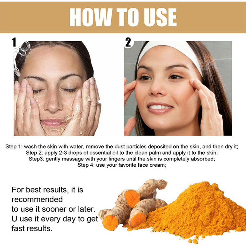 Best of Turmeric Freckle Whitening Serum Fade Dark Spots Removal Pigment Melanin Correcting Facial Beauty Face Skin Care Products 30ml Reviews & Tips - Image 6