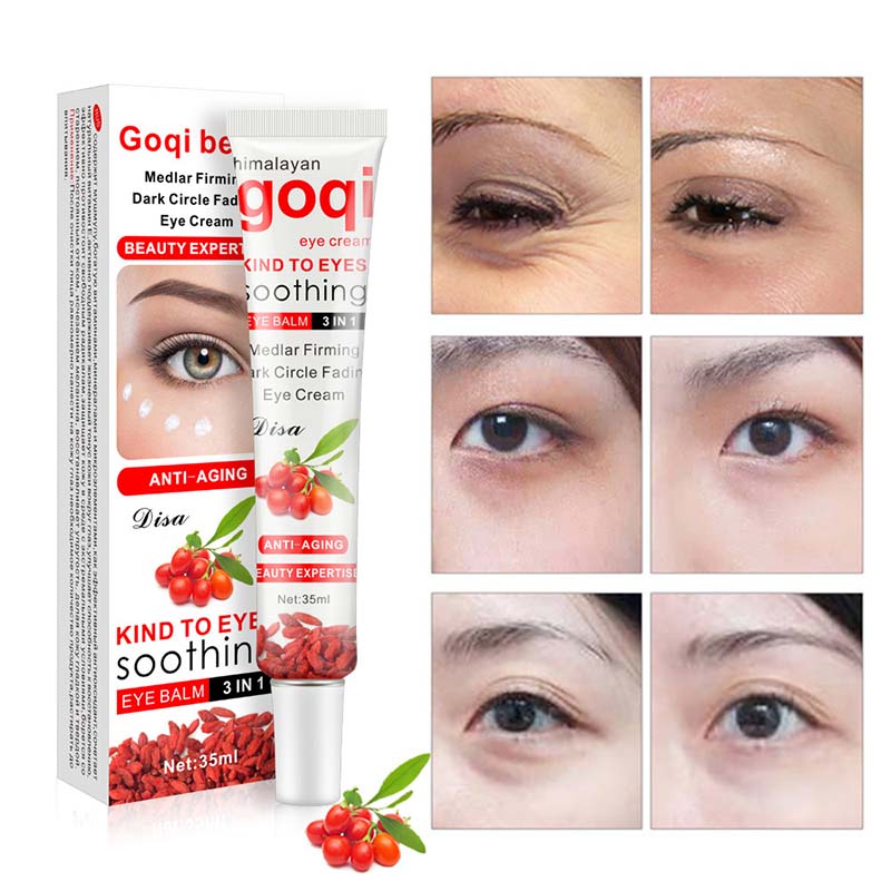 Best of Goji Berry Eye Cream Peptide Collagen Serum Anti-Wrinkle Anti-Age Remove Dark Circles Against Puffiness And Bags Eye Care Reviews & Tips