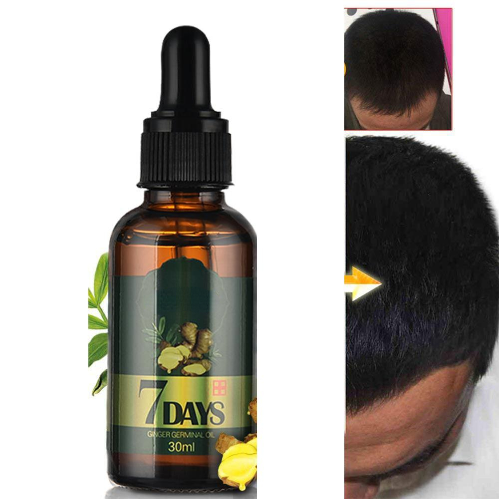 Best of Hair Growth Essential Oils Ginger Germinal Oil Fast Hair Growth Anti-Hair Loss Alopecia Treatment Beauty Dense Hair Growth Serum Reviews & Tips