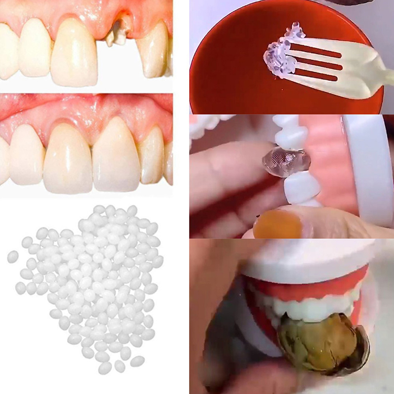 Best of Resin 10g / 15g / 20g Temporary Tooth Repair Kit Teeth And Gaps FalseTeeth Solid Glue Denture Adhesive Teeth Whitening Tooth Beauty Reviews & Tips - Image 5