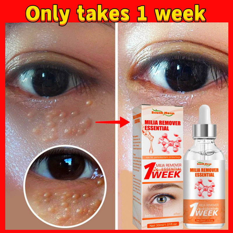 Best of Fat Granules Removal Serum Fade Dark Circles Eye Bags Moisturizing Essence Firming Anti-Puffiness Wrinkles Brighten Beauty Care Reviews & Tips