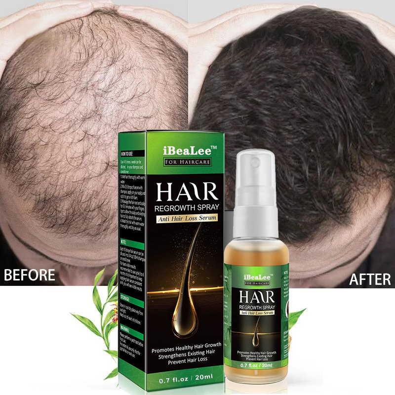 Best of Ginger Hair Growth Products Fast Growing Hair Essential Oil Beauty Hair Care Prevent Hair Loss Oil Scalp Treatment For Men Women Reviews & Tips